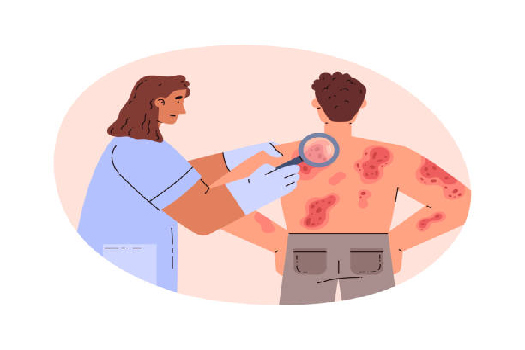 الصدفية والعناية بالبشرة: دليل عملي لعام 2025